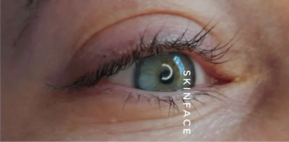 Before image